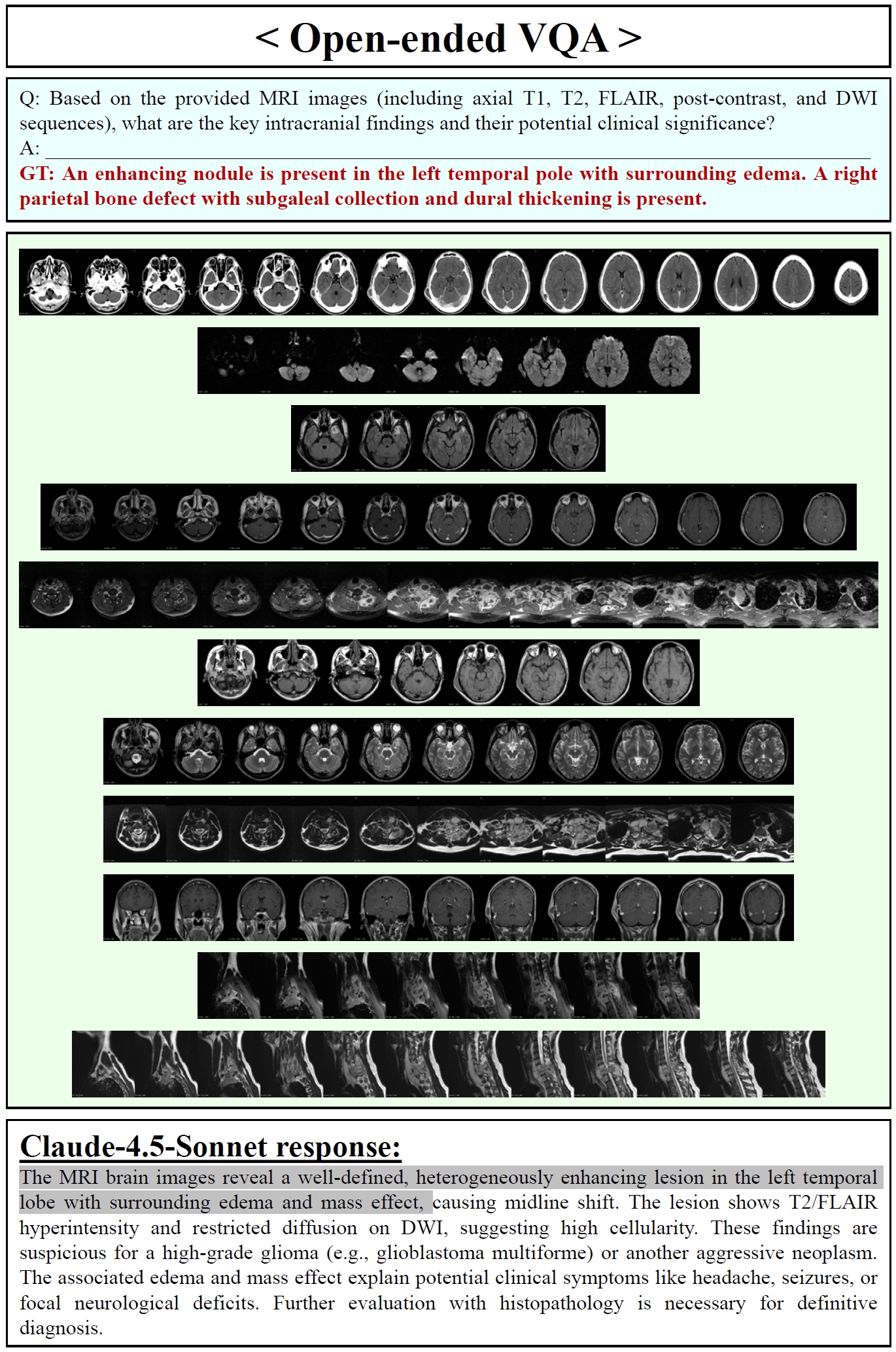 Claude-4.5-Sonnet Open-ended VQA Samples